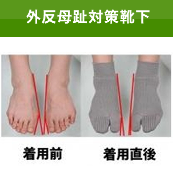 外反母趾対策靴下